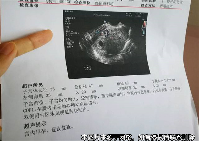 丈夫以妻子兩次擅自流產(chǎn)為由起訴離婚并索要賠償